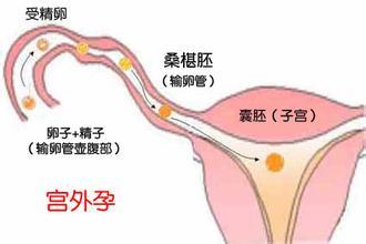 石家庄省人民医院的借卵做试管婴儿提示